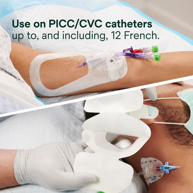 PICC/CVC catheter insertion with medical personnel and text indicating use on up to 12 French catheters. - okotoks hc pharmacy