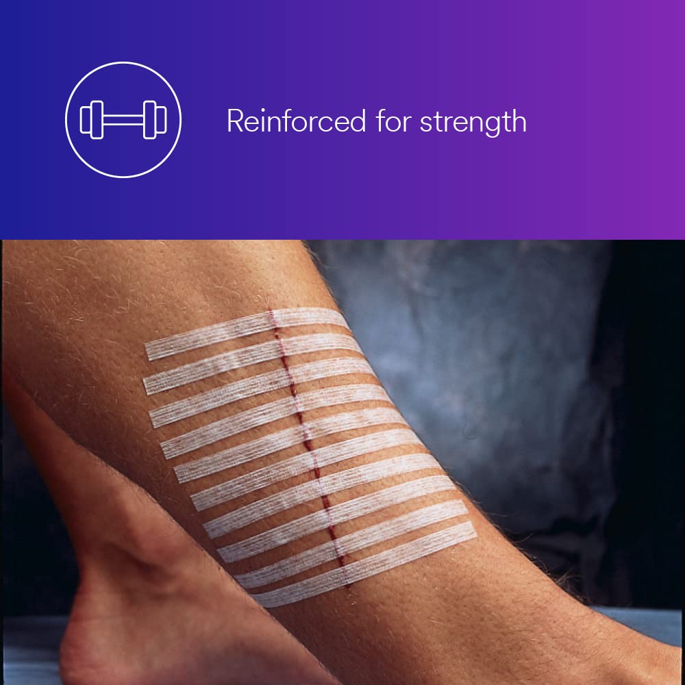 Strips of adhesive tape applied to a person's arm with a purple background - okotoks hc pharmacy