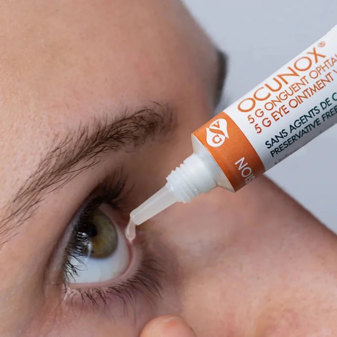 Person applying eye ointment to their eye with a tube labeled 'Ocunox' visible. - okotoks hc pharmacy