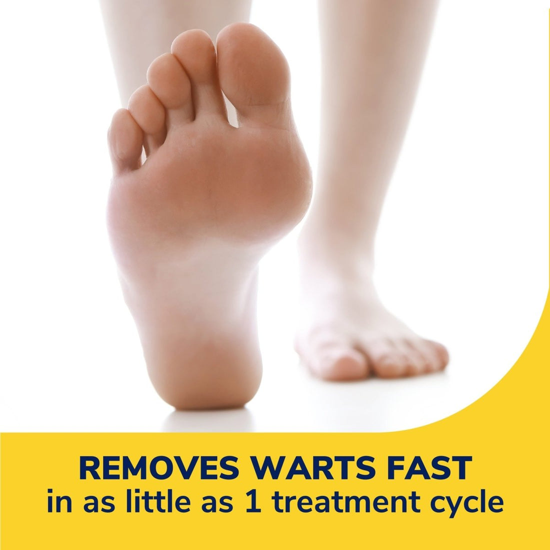 Close-up of a foot with text about warts removal on a yellow and white background - okotoks hc pharmacy