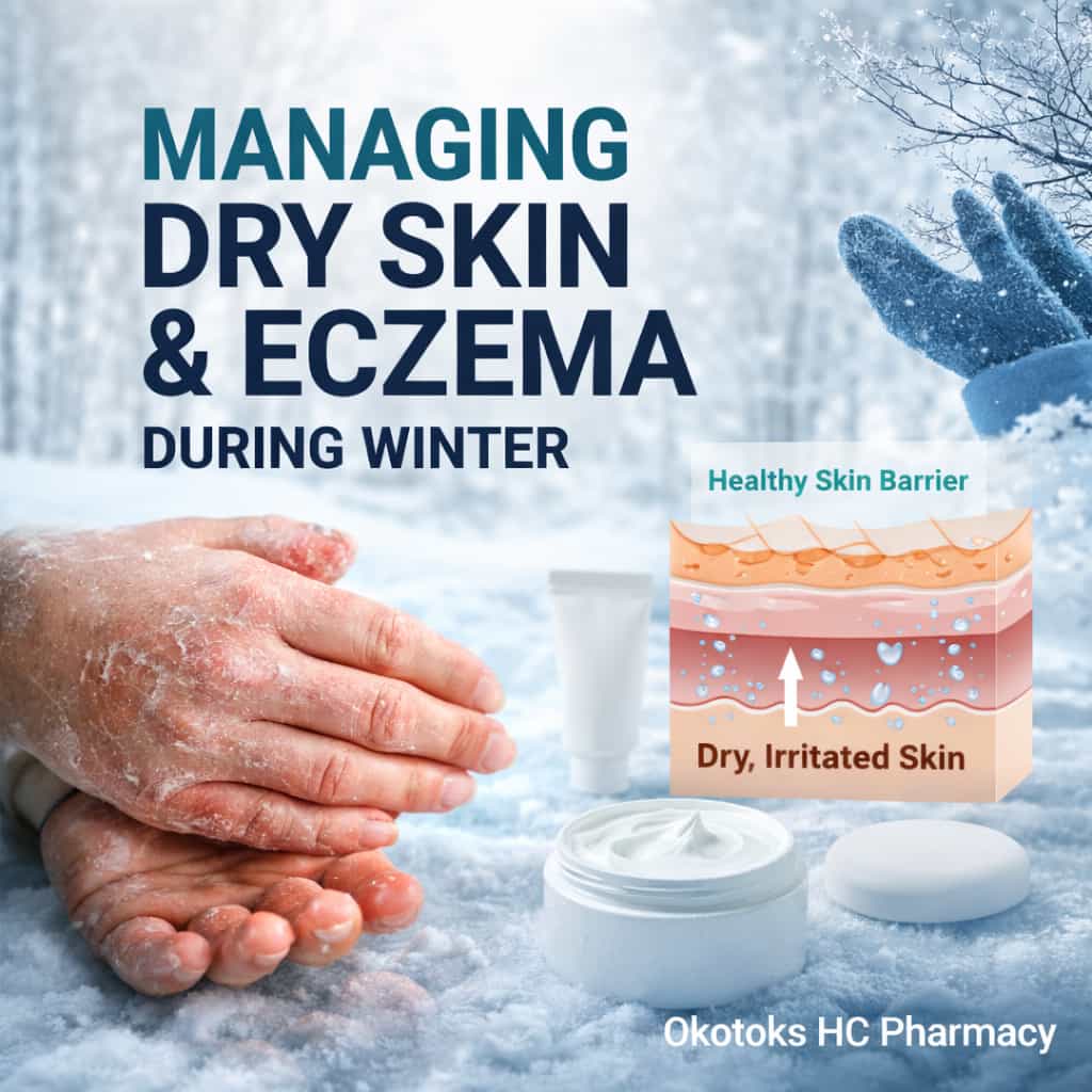 Managing Dry Skin & Eczema During Alberta Winters