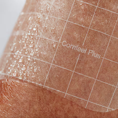 Patch labeled 'Comfeel Plus' on skin with grid overlay - okotoks hc pharmacy
