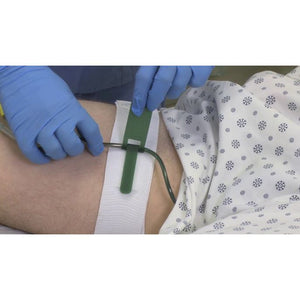 Person with a catheter holder on their leg, wearing blue gloves, in a medical setting. - okotoks hc pharmacy