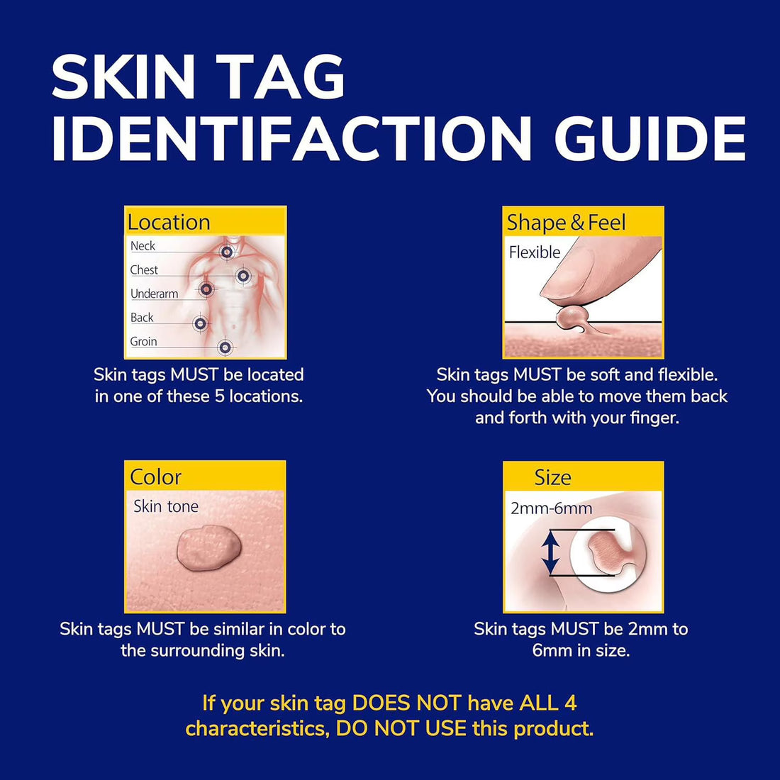 Skin tag identification guide with illustrations and text on a blue background - okotoks hc pharmacy