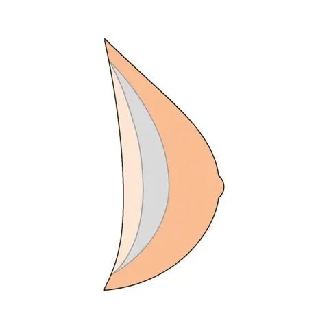Amoena Natura Light 2S Breast Form 390 - Ivory - okotoks hc pharmacy