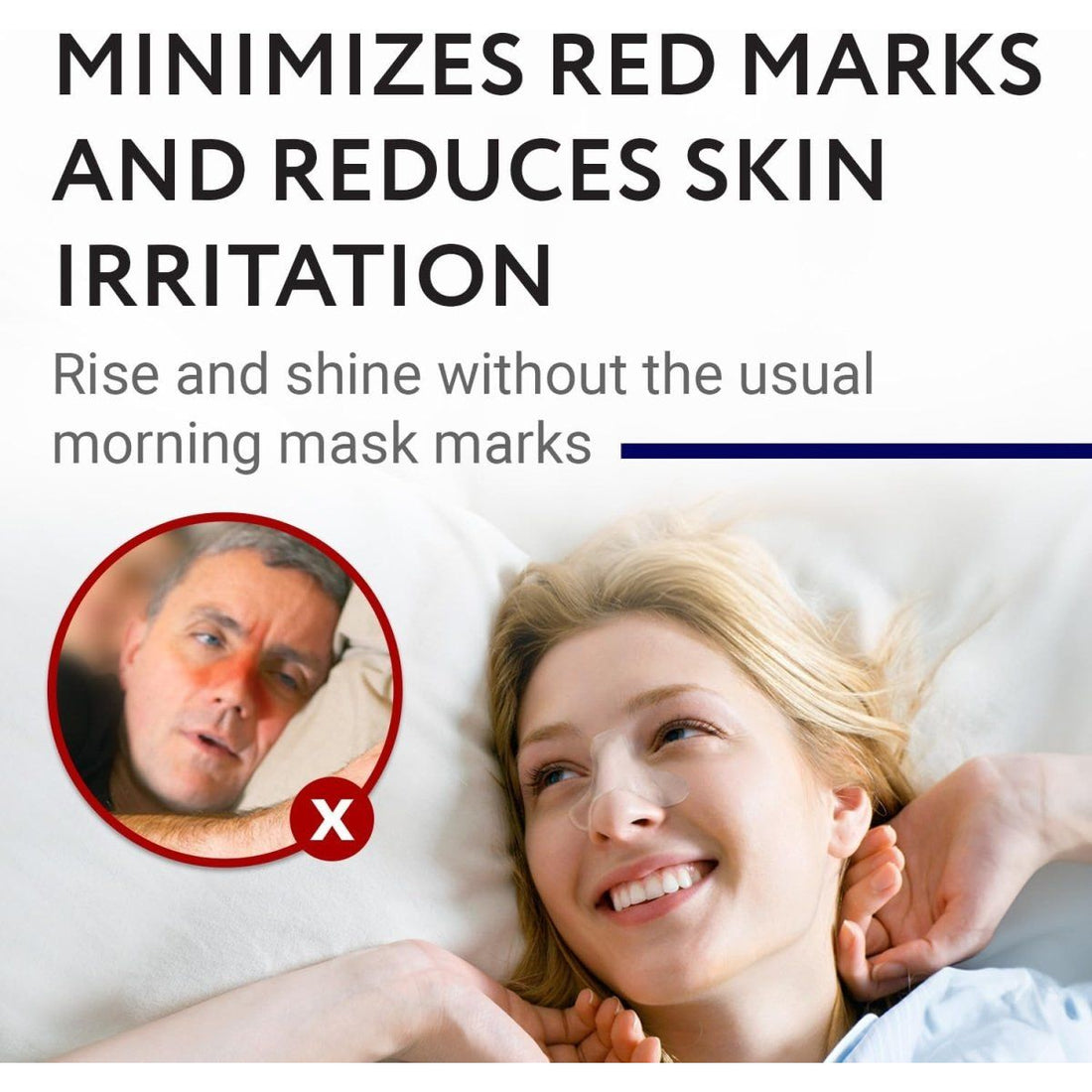 Advertisement showing a woman lying down with a close-up of a man's face with red marks, promoting a product that minimizes red marks and reduces skin irritation. - okotoks hc pharmacy