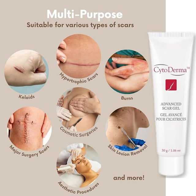 CytoDerma Advanced Scar Gel advertisement with images of scars and a tube of gel. - okotoks hc pharmacy