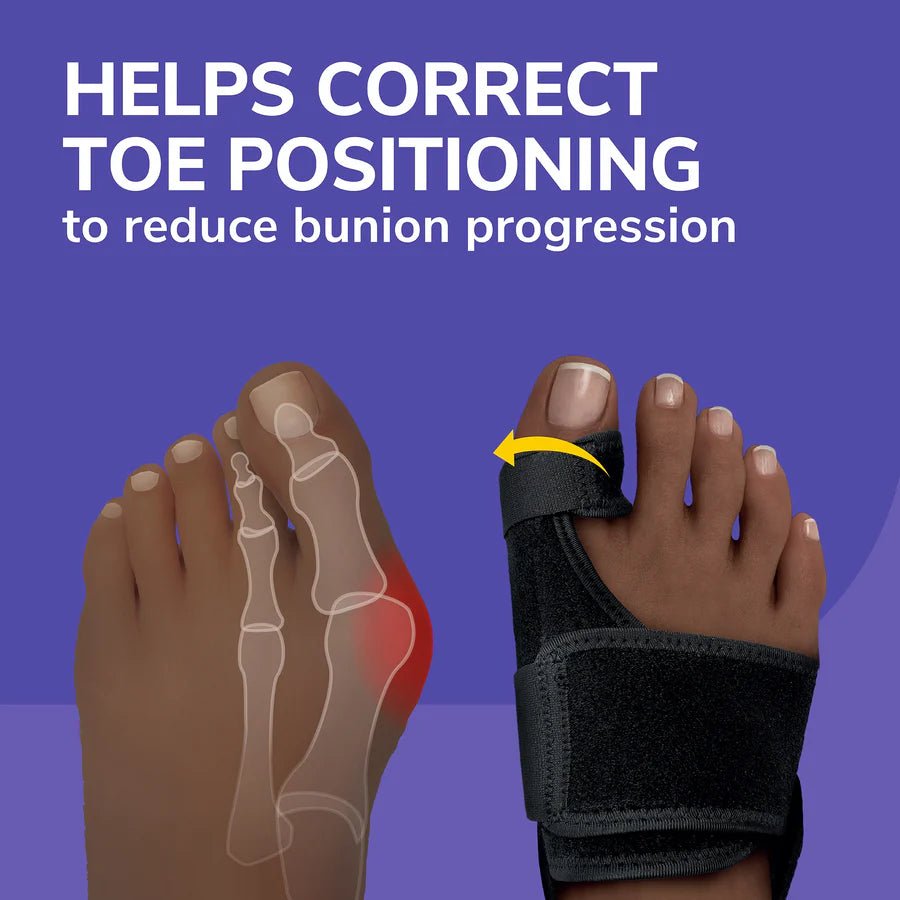 Bunion corrector with foot illustration on a purple background - okotoks hc pharmacy