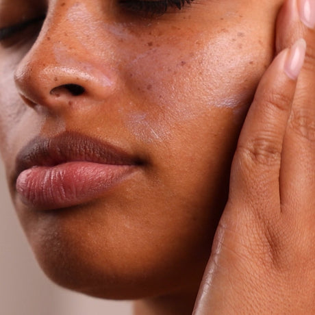 Close-up of a person's face with a hand on their cheek, focusing on skin texture. - okotoks hc pharmacy