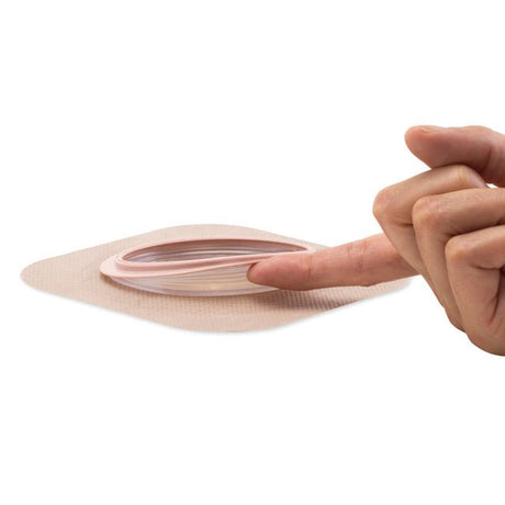 Hollister New Image™ Soft Convex CeraPlus™ 2-Piece Ostomy Skin Barrier - Tape - Cut to Fit 1-1/2" (38mm) - HOL 11703 - Okotoks HC Pharmacy