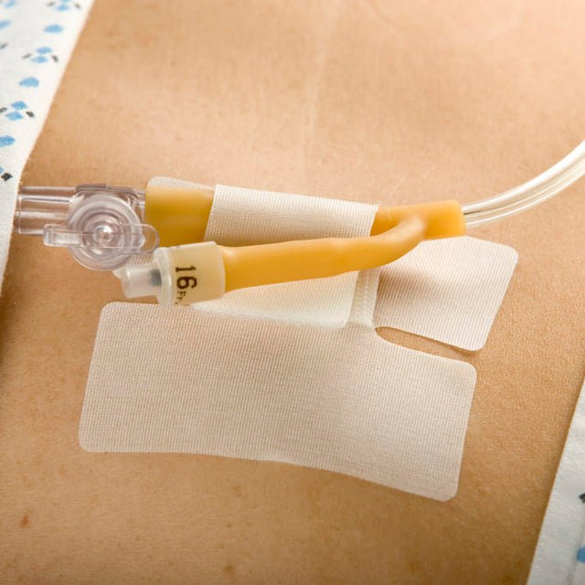 IV catheter with a clear tube attached to a person's arm, with a patterned fabric background. - okotoks hc pharmacy