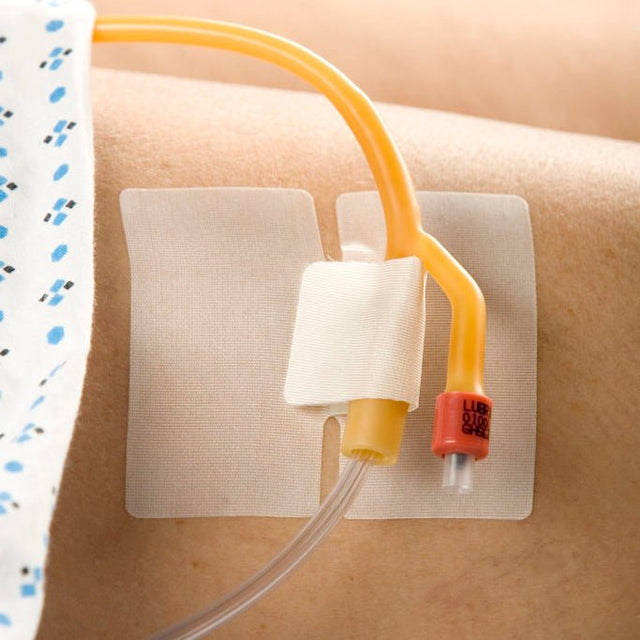 IV catheter with clear tubing attached to a patient's arm against a blue background - okotoks hc pharmacy