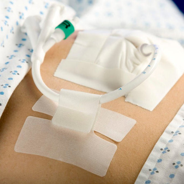 Person lying in bed with medical adhesive patches on their abdomen - okotoks hc pharmacy