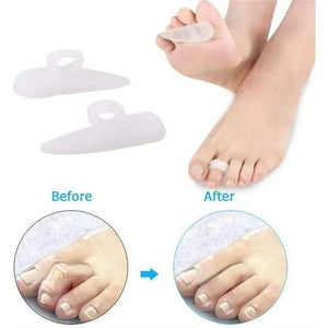 Silicone gel pads for toe separation with 'Before' and 'After' comparisons on a white background. - okotoks hc pharmacy