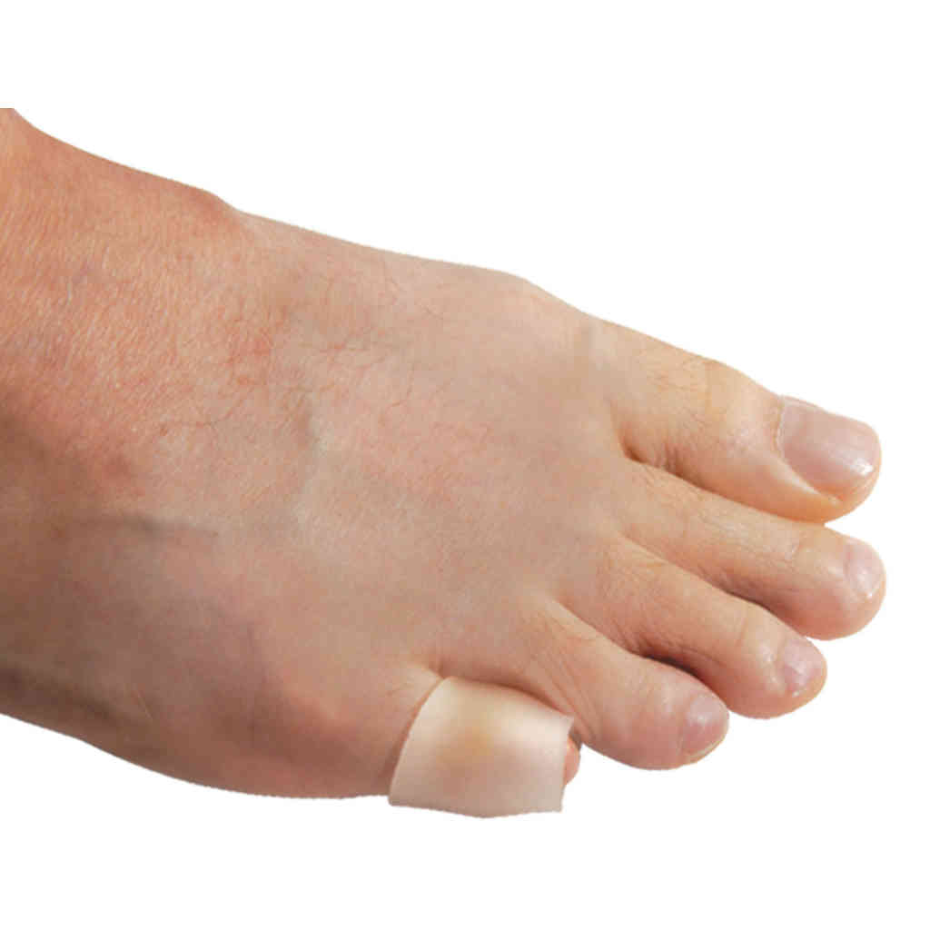 Foot with a bunion correction device on a white background - okotoks hc pharmacy